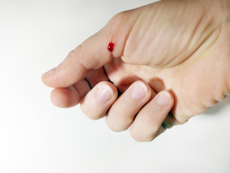 Как остановить кровь после ушиба