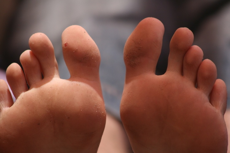Как вылечить ушиб пальцев ноги